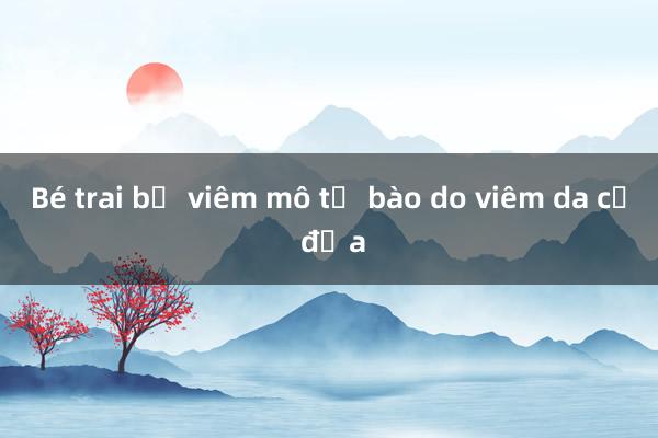 Bé trai bị viêm mô tế bào do viêm da cơ địa